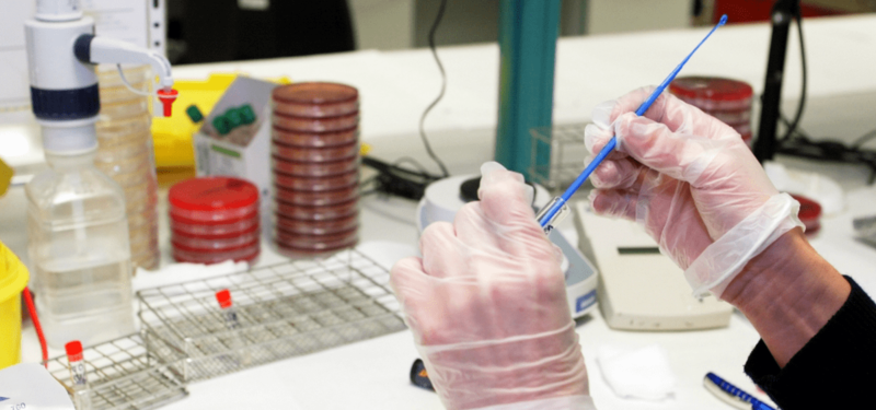 Imagen de archivo de unas pruebas de diagnóstico de viruela del mono / TA